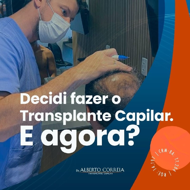 Implante capilar preço no brasil