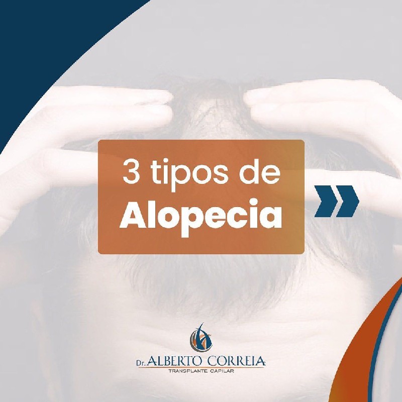 Tratamento capilar alopecia