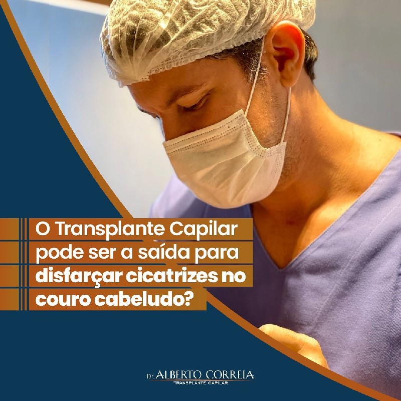 Valor transplante capilar brasil